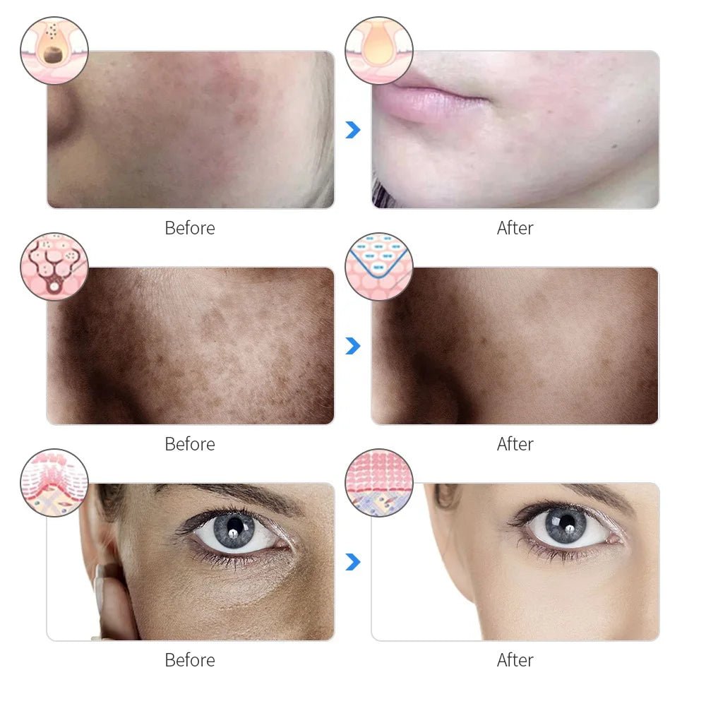 LumiSkin Pro 7 - Máscara LED recargable 7 colores LED Photon Beauty Mask Rejuvenecimiento de la piel - Hogar Elegance